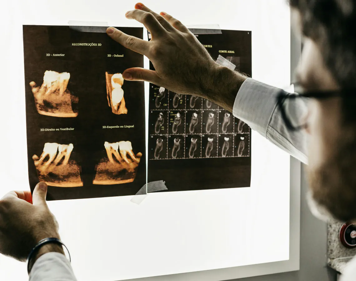 Ortodoncia Removible