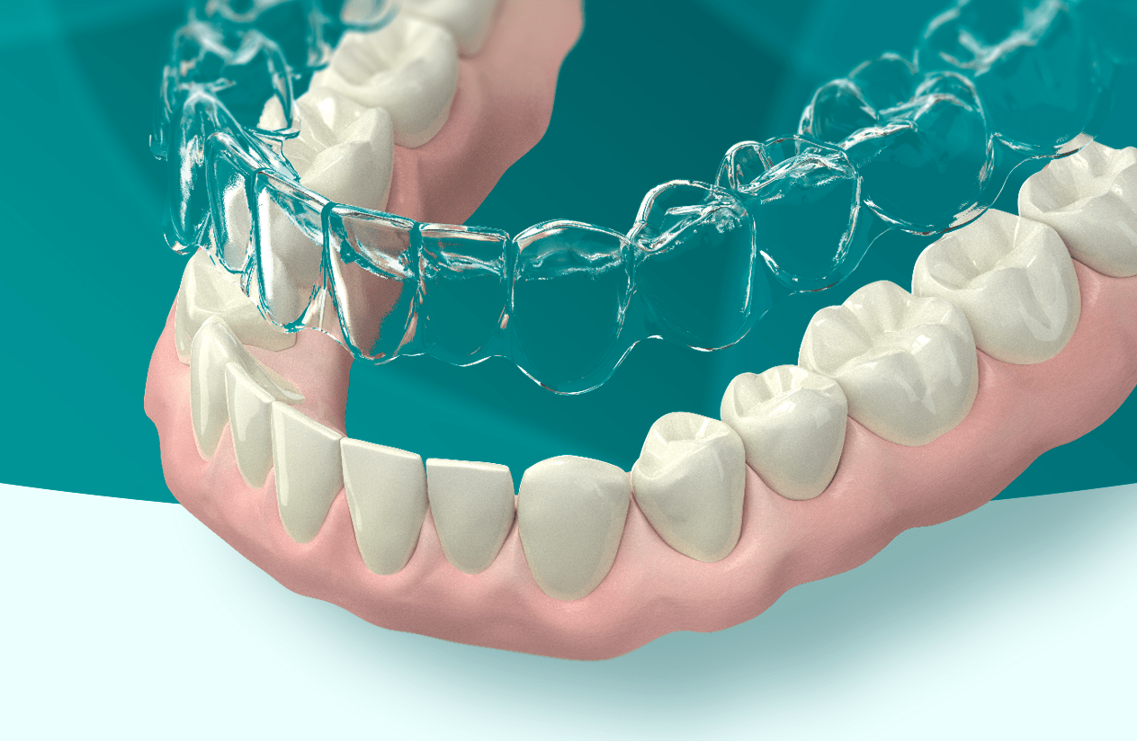 Alineador Holográfico 3D